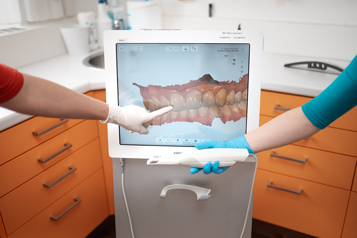 3D-Scanner